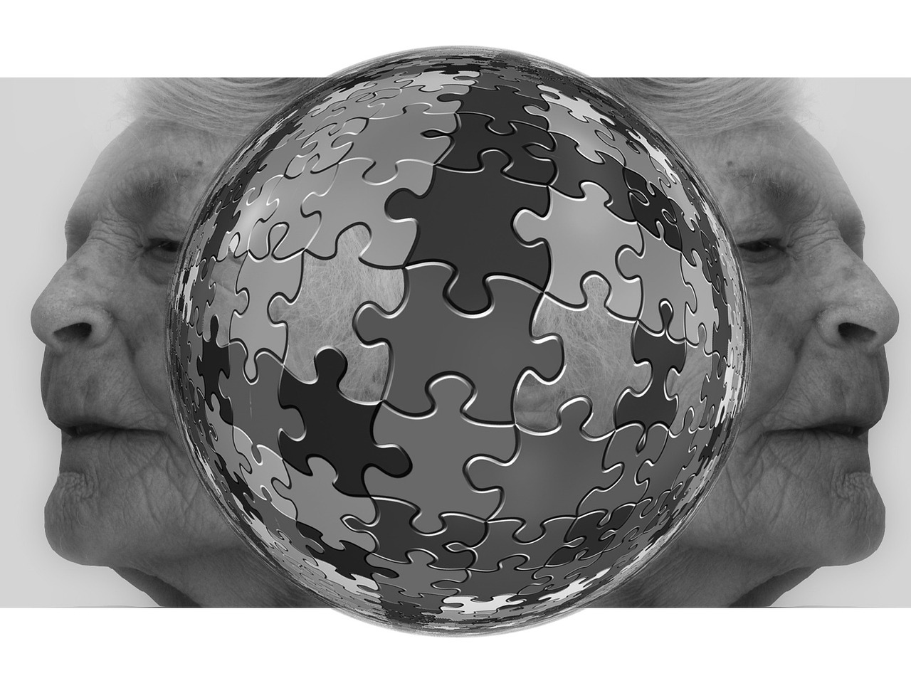 Alzheimer’s gene: APOE’s unexpected role in most cases APOE gene Alzheimer brain