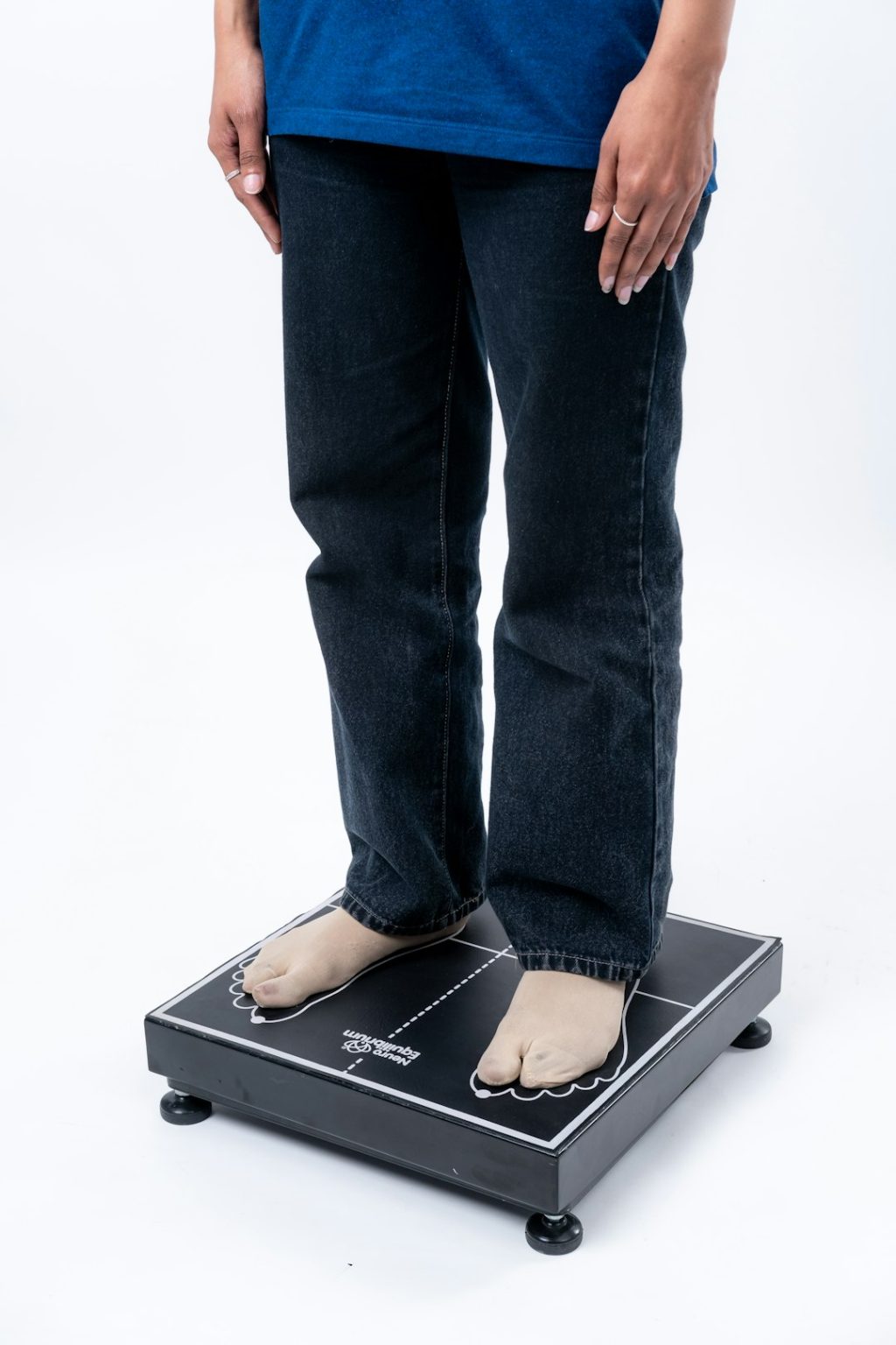 bariatric surgery weight loss