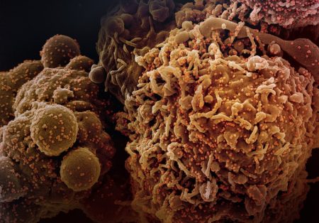 Chemotherapy rewires gut bacteria to block metastasis chemotherapy gut bacteria cancer research