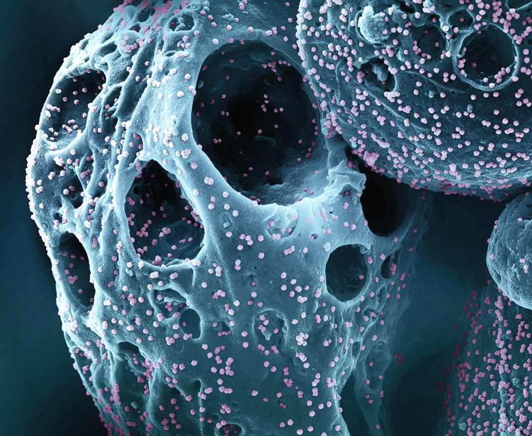 Magnetic nanoparticles target bone cancer and aid healing magnetic nanoparticles bone cancer healing